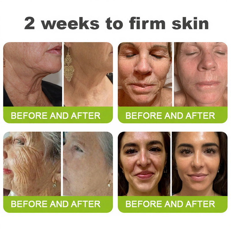 Skin Tightening & Vita-A Retinol Shot