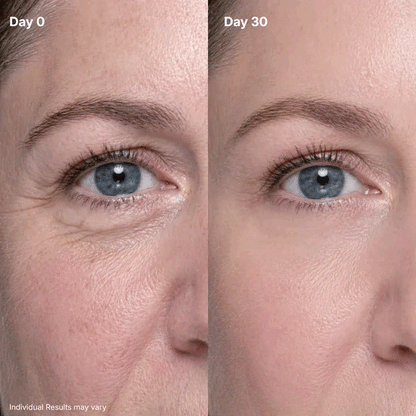 AQA🔥P7 Eye Renewal Cream-1